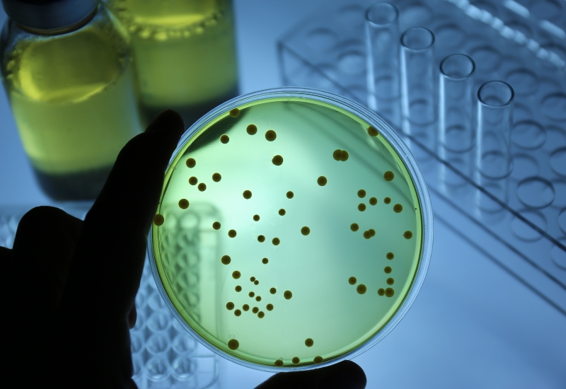 Tests before sterilization
